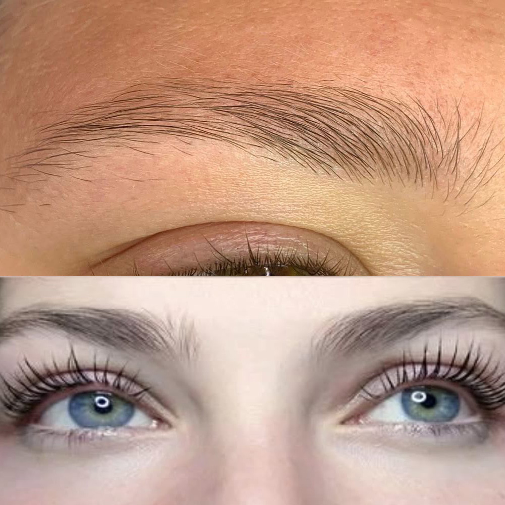 lifting-nataliyas-beauty-care.